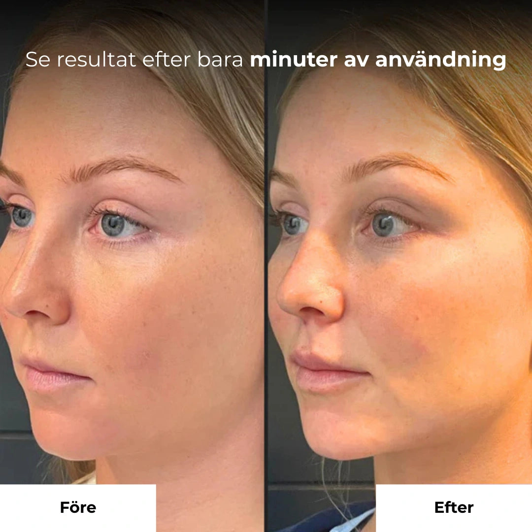 ContourPro Roller - Lyfter, formar & återupplivar din hud