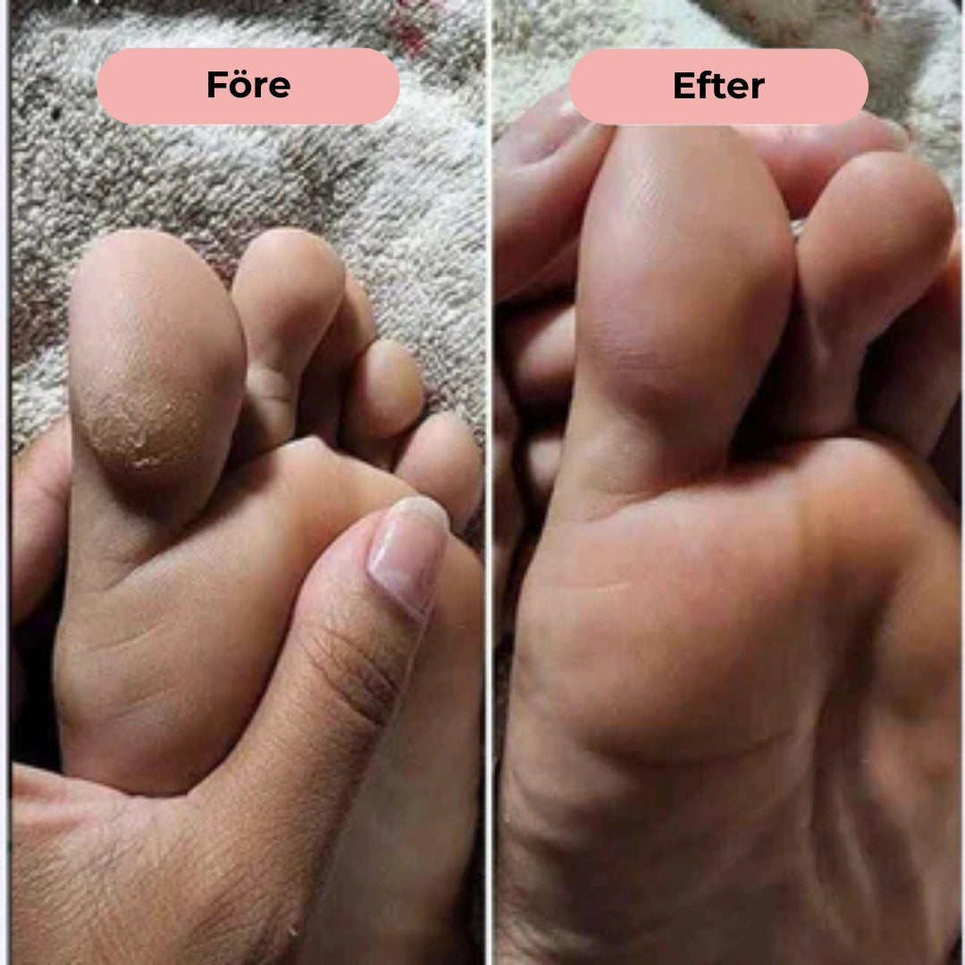 Glow Feet - Kraftfull Fotfil med LED-ljus