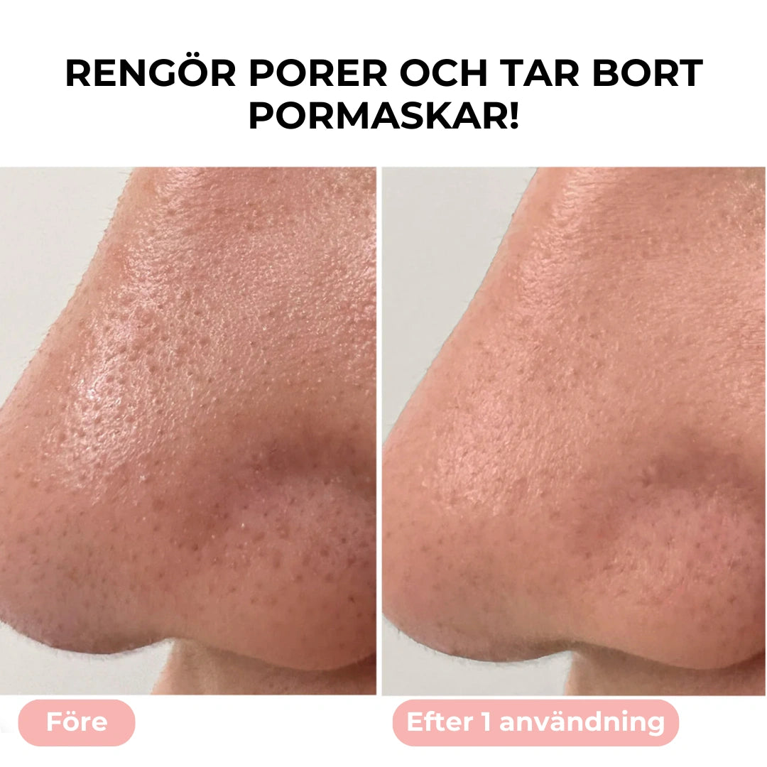PureGlow - Pormaskborttagare med Vakuumteknik
