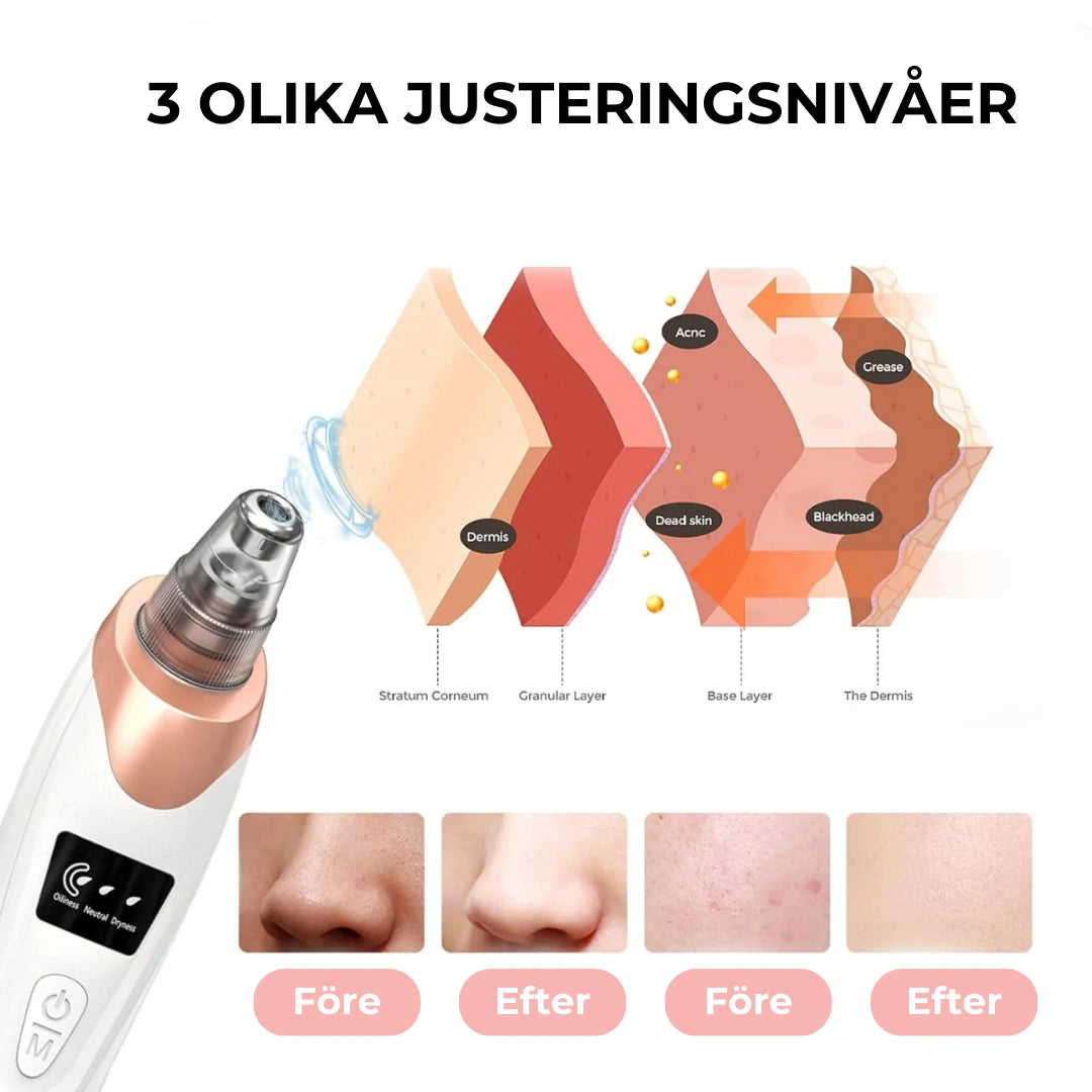PureGlow - Pormaskborttagare med Vakuumteknik