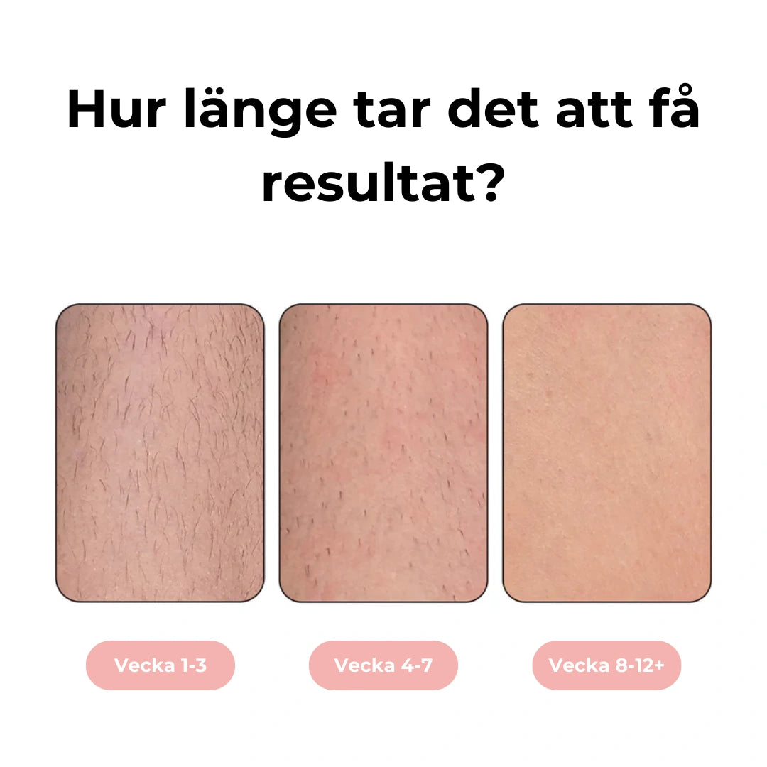 Silkella IPL - Smärtfri och permanent hårborttagning